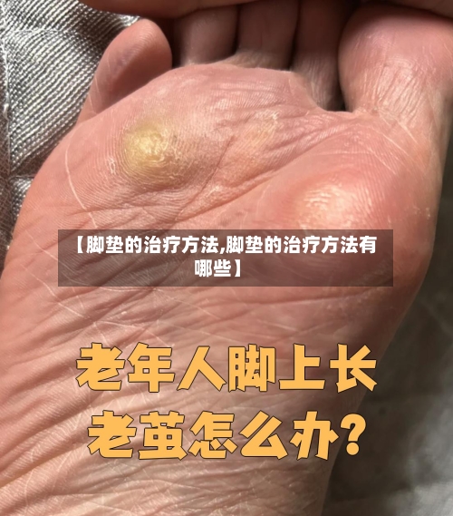 【脚垫的治疗方法,脚垫的治疗方法有哪些】
